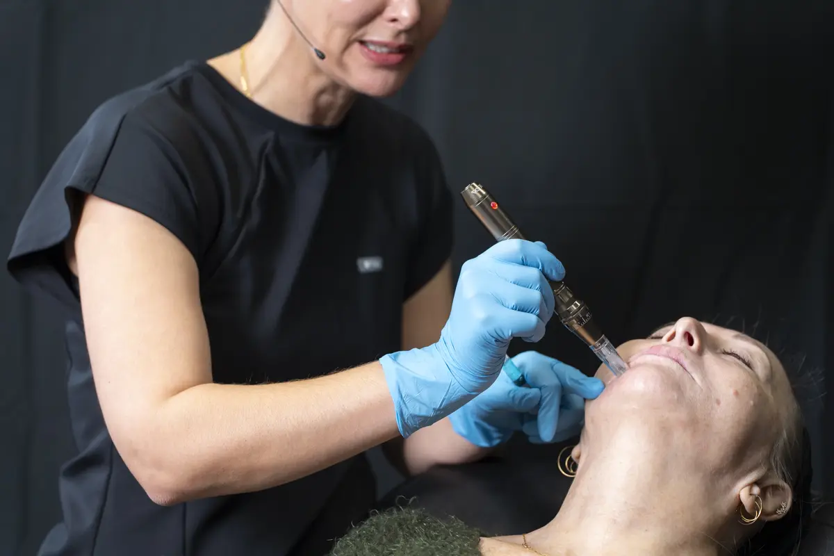 Live aesthetic treatment demonstration.