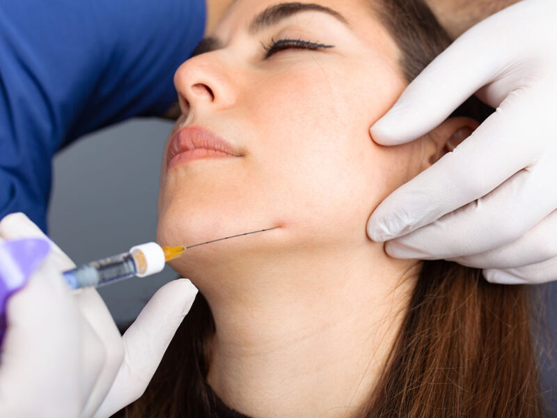 Dermal Fillers & Botox Injection to the lower face