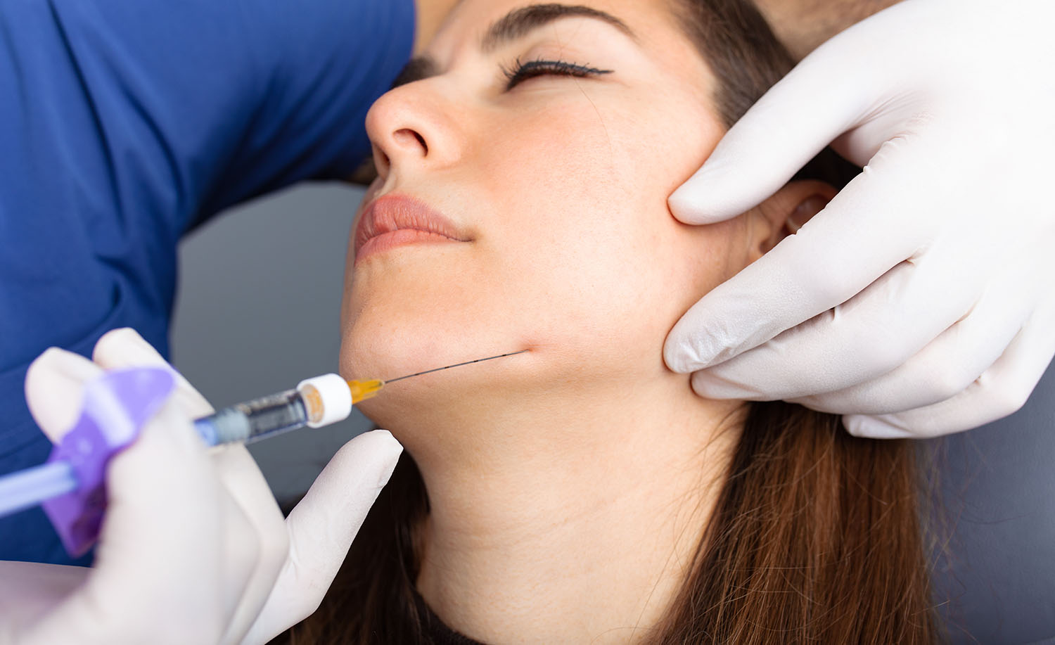 Dermal Fillers & Botox Injection to the lower face